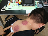 Bien-être de l'entreprise - science médicale chinoise traditionnelle entrant dans le bureau